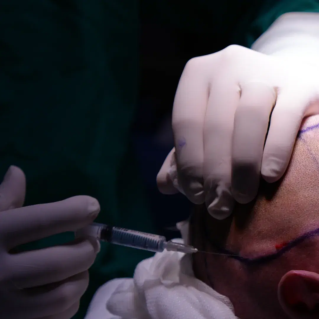 <p><span style="color: rgb(247, 248, 248);"><strong>Stem Cell Extraction and Application</strong></span></p>