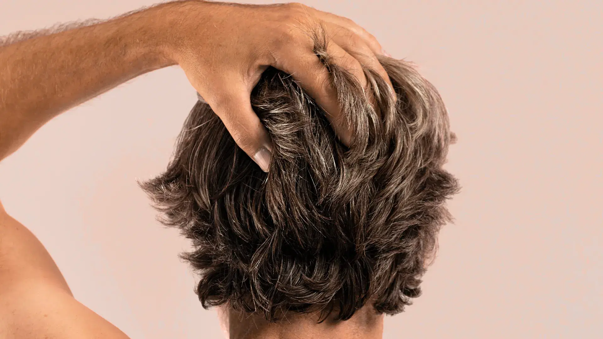 Beneficios del PRP para el cabello