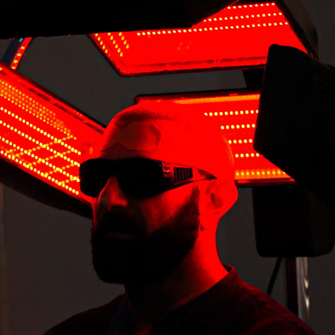 Beneficios de la terapia de luz roja para el crecimiento capilar después del trasplante
