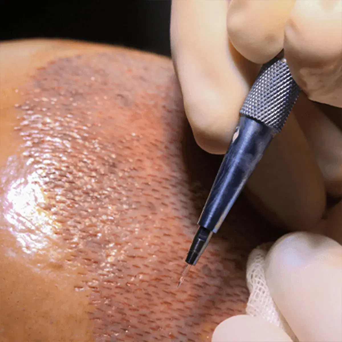 Perché la DHI è una soluzione più moderna?