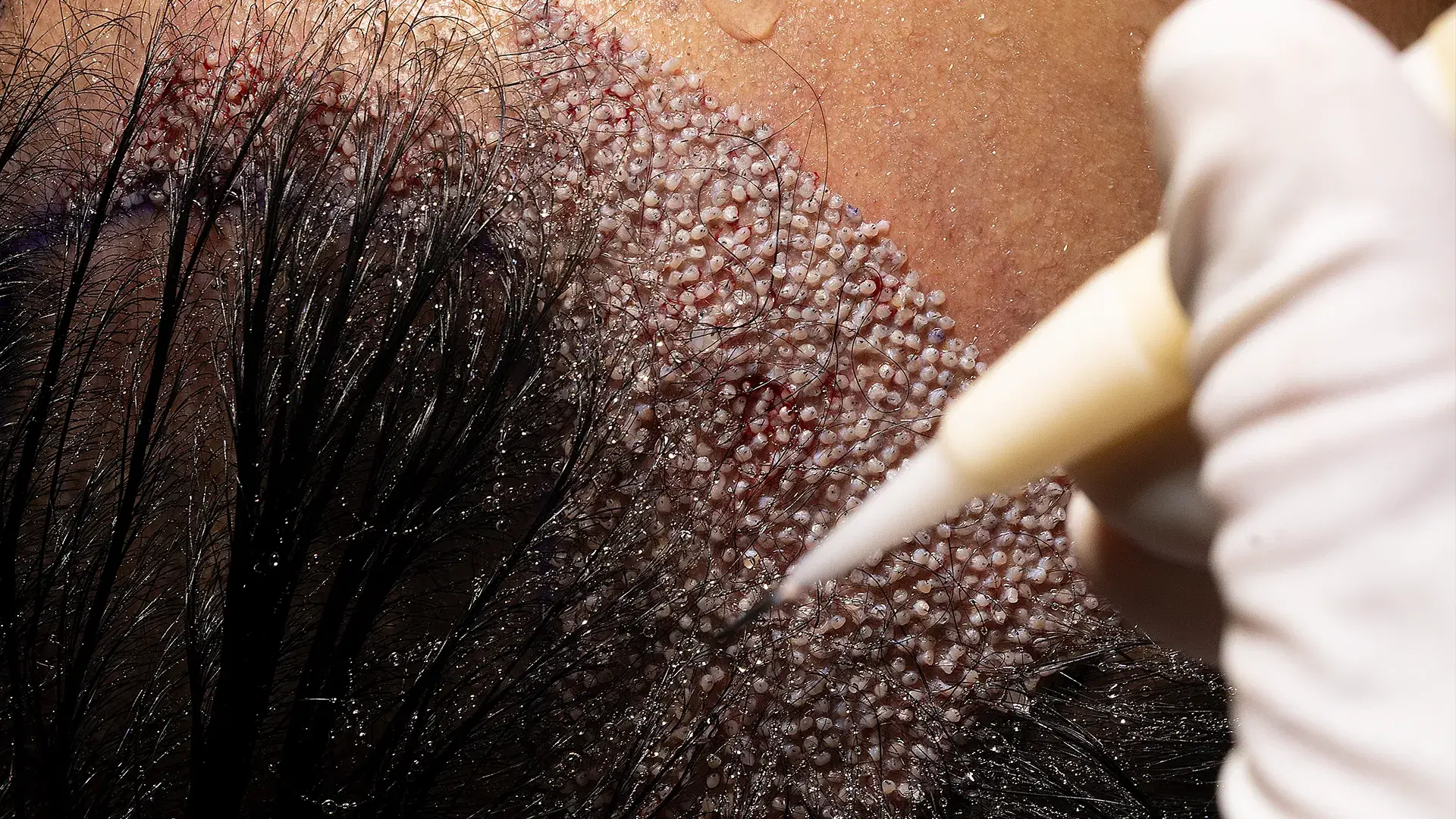 ¿Por qué la DHI es una solución más moderna?