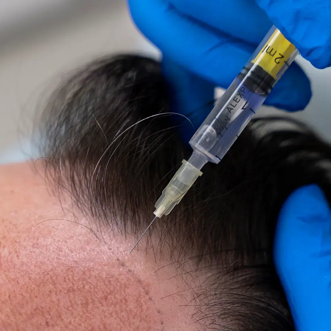 <h3><span style="color: rgb(247, 248, 248);"><strong>Nutrient Microinjections</strong></span></h3><p></p>