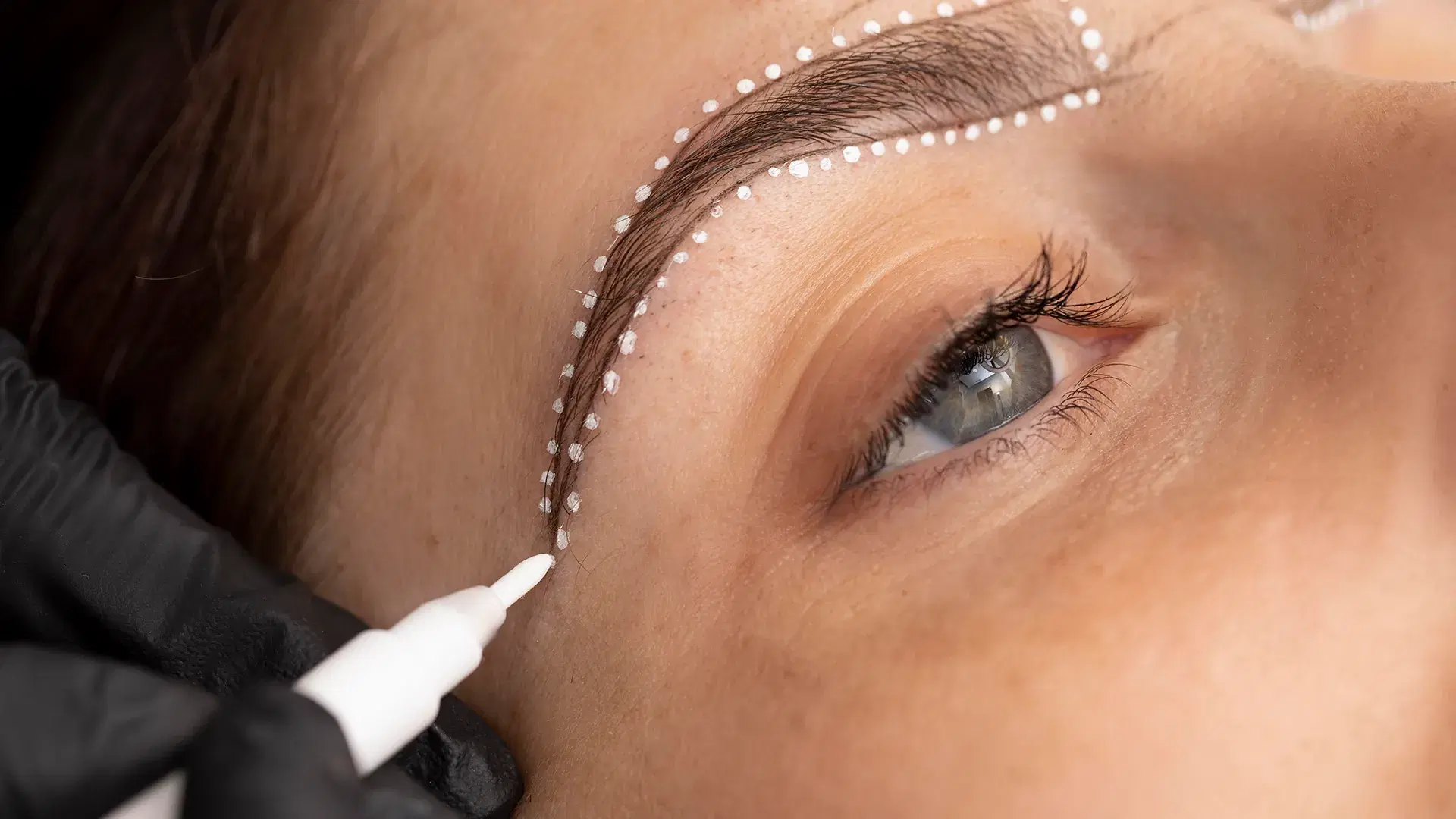What Is a DHI Eyebrow Transplant?