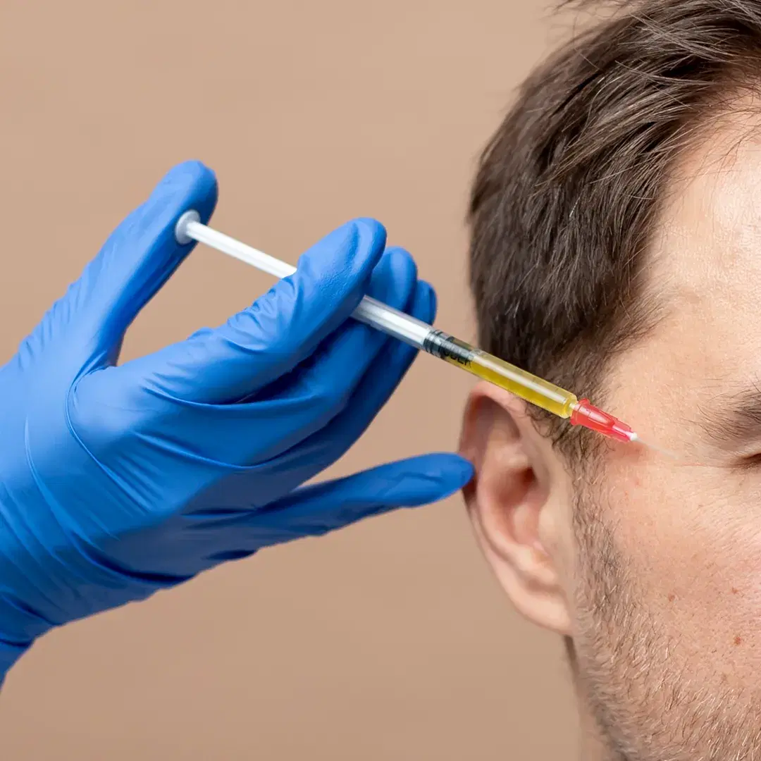 PRP for Hair: Stimulate Natural Growth and Thickness