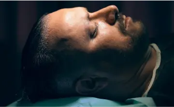 Pre-Hair Transplant Evaluation and Planning